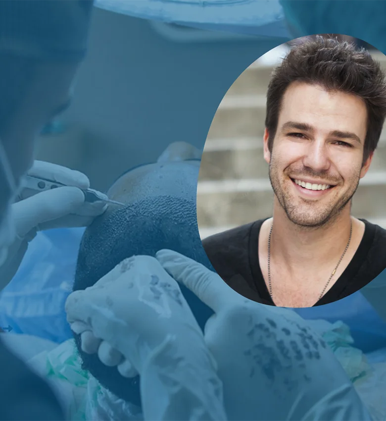 Hair Transplantation